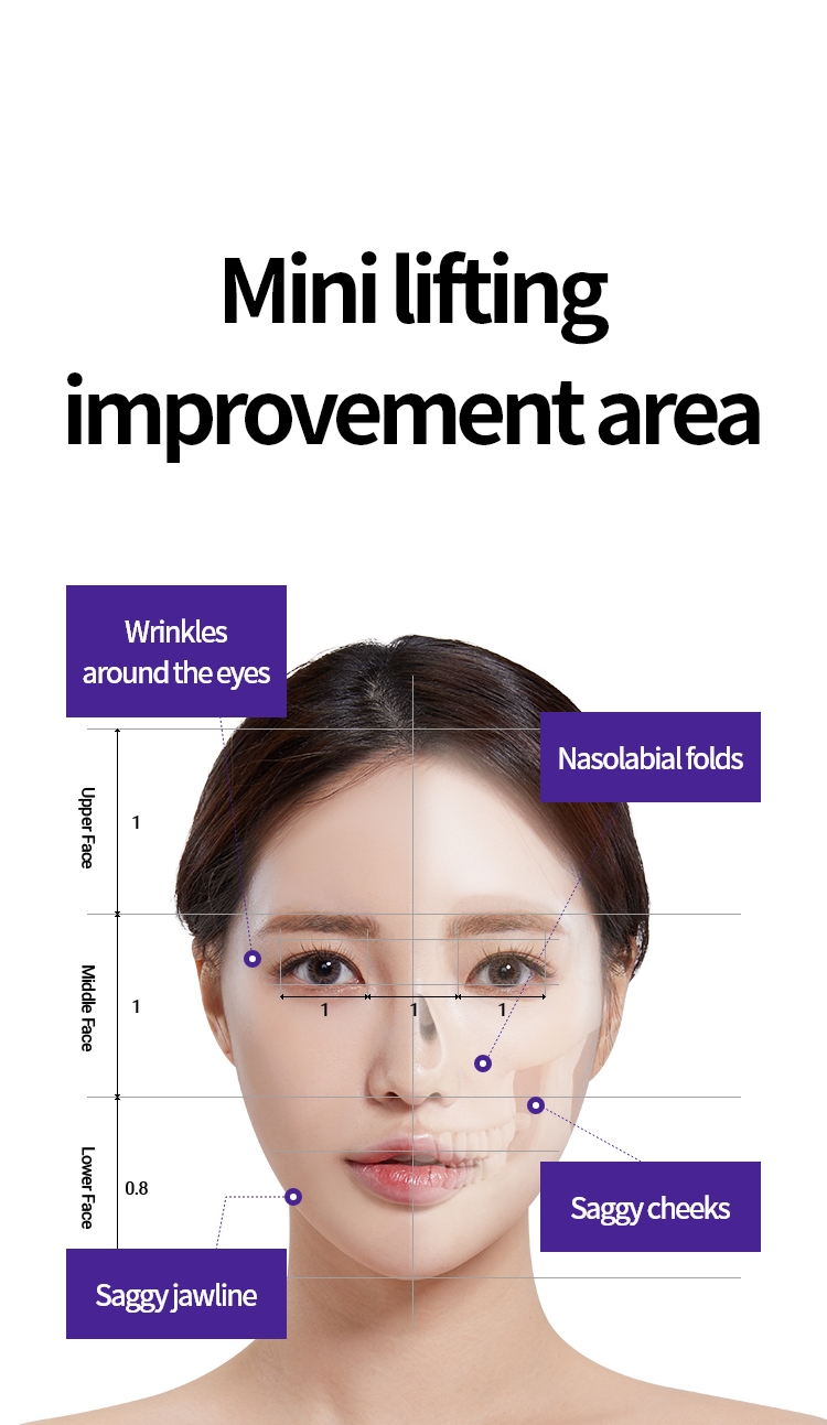 미니리프팅 개선 부위 / 눈가주름, 팔자루름, 처진턱선, 처진 볼살 / UpperFace:1, Middle Face:1, Lower Face:0.8