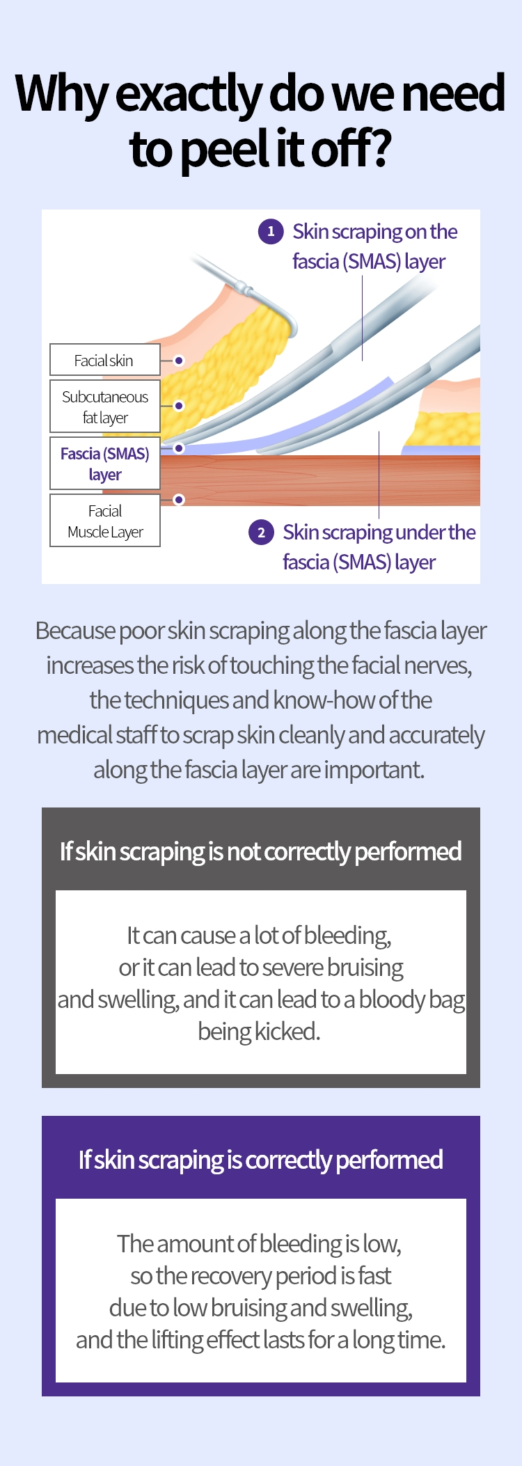 
			정확하게 박리해야 하는 이유:

			근막(SMAS)층을 따라 박리를 잘 못할 경우
			안면신경을 건드릴 위험성이 커지기 때문에
			근막(SMAS)층을 따라 깨끗하고 정확하게
			박리할 수 있는 의료진의 테크닉과 노하우가
			중요합니다
			