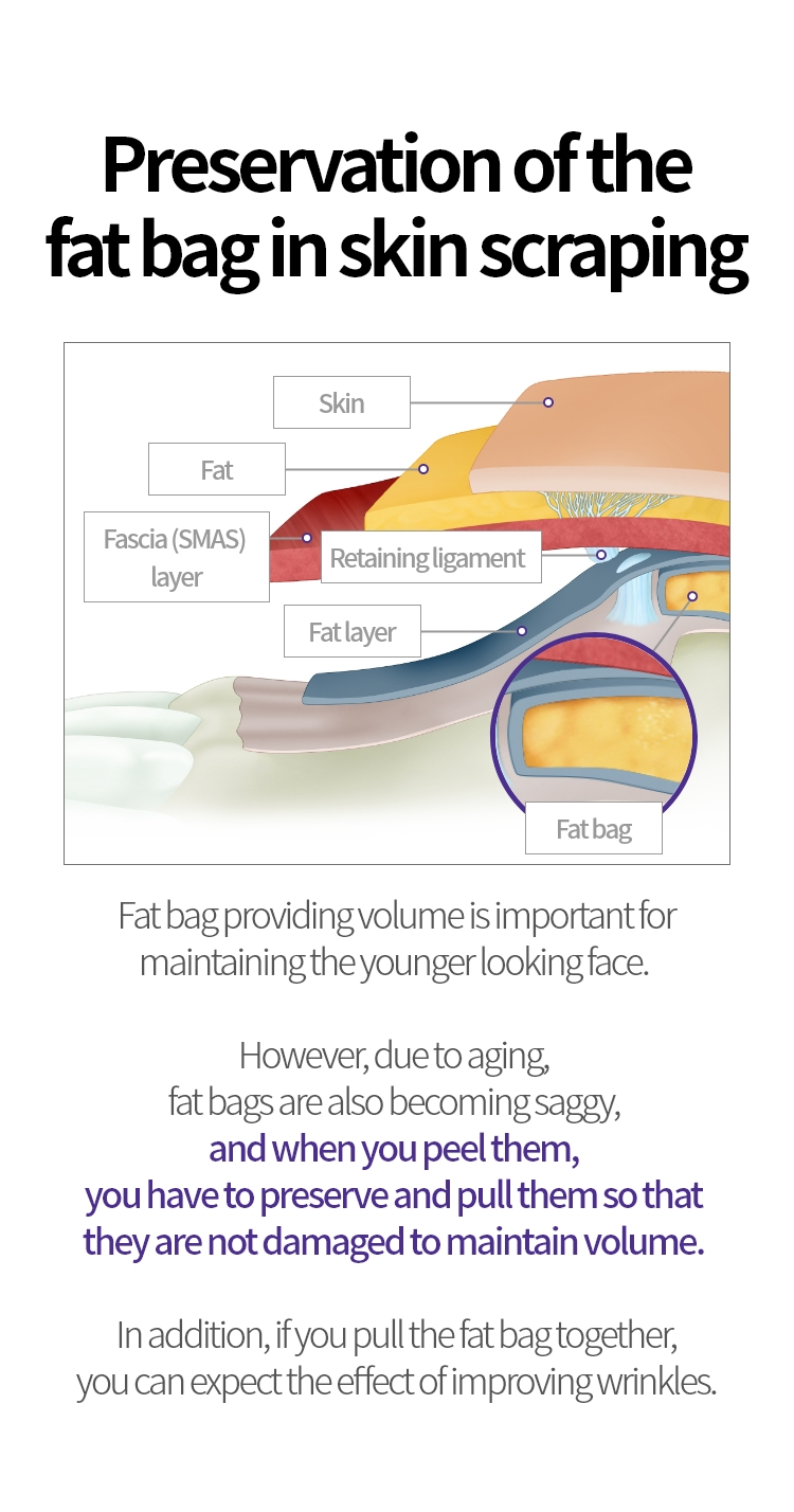 
			정확하게 박리해야 하는 이유:

			근막(SMAS)층을 따라 박리를 잘 못할 경우
			안면신경을 건드릴 위험성이 커지기 때문에
			근막(SMAS)층을 따라 깨끗하고 정확하게
			박리할 수 있는 의료진의 테크닉과 노하우가
			중요합니다
			