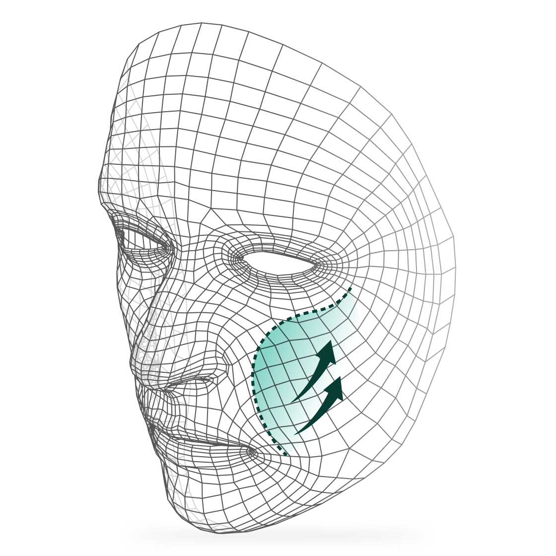 Facial Elevation