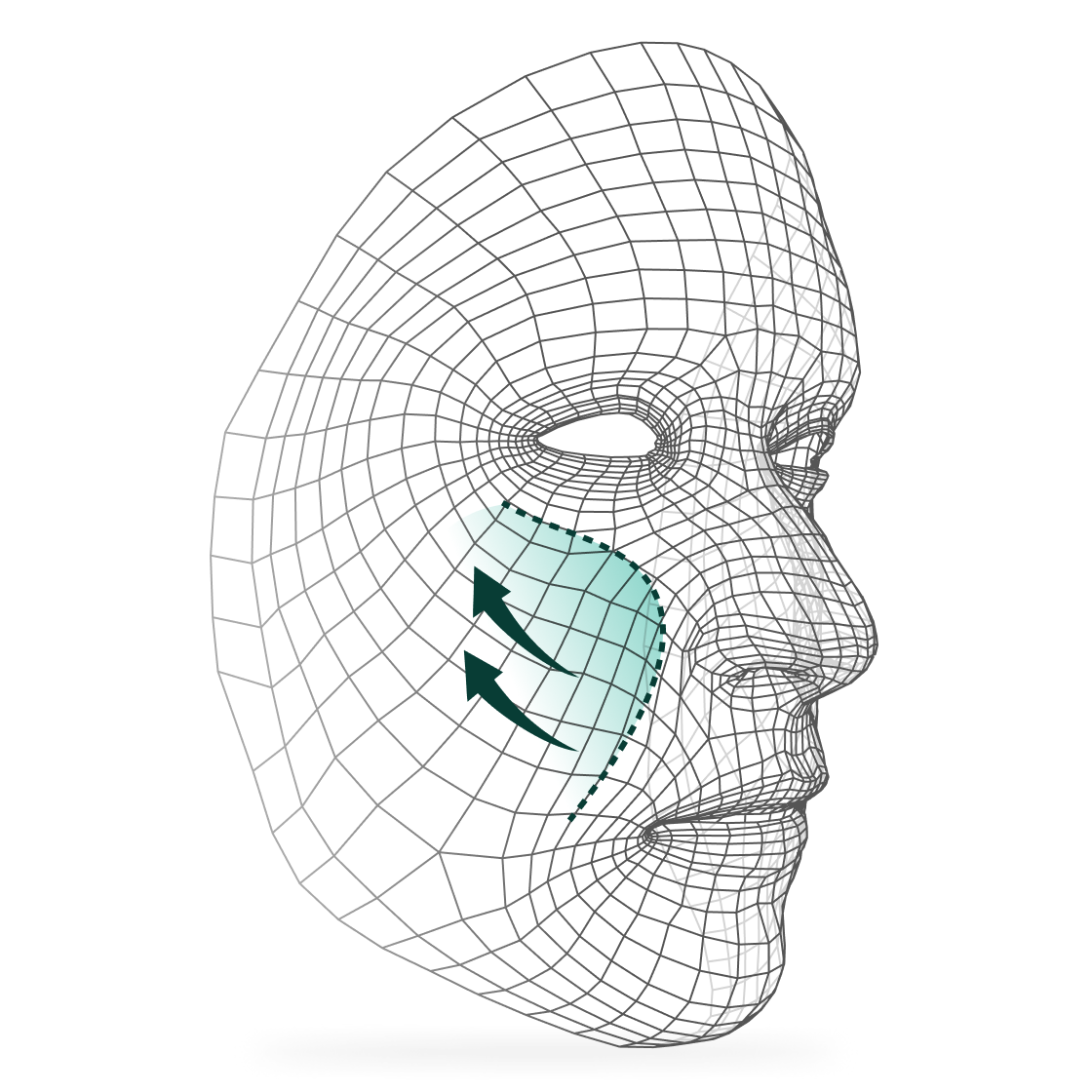 Facial Elevation