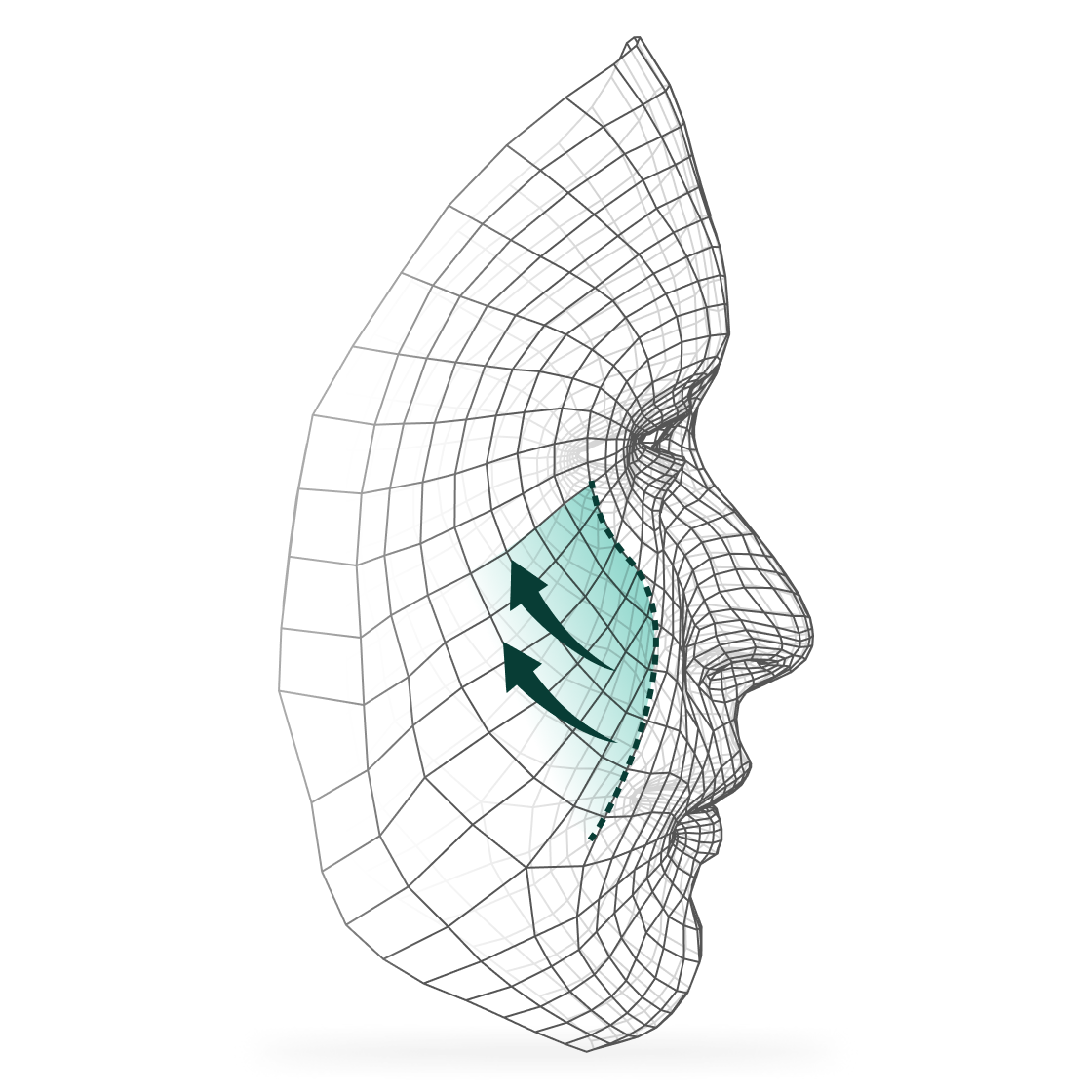 Facial Elevation