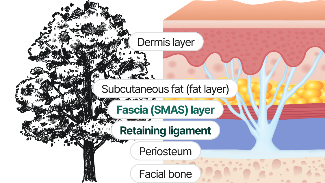 Dermis, Subcutaneous Fat (Fat Layer), Fascia (SMAS), Supporting Ligaments, Periosteum, Facial Bones