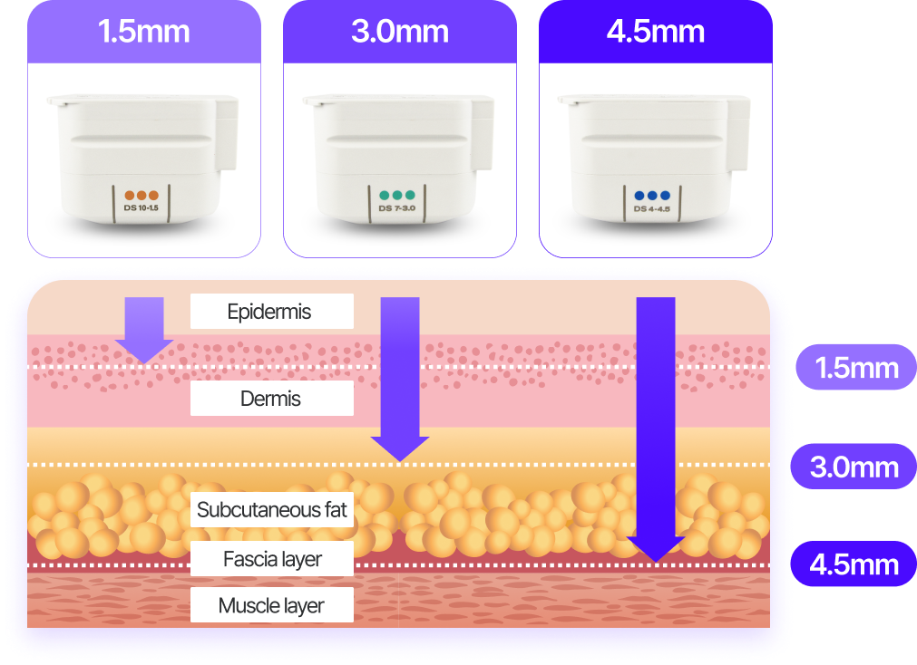 Epidermis, Dermis, Subcutaneous fat, Fascia layer, Muscle layer