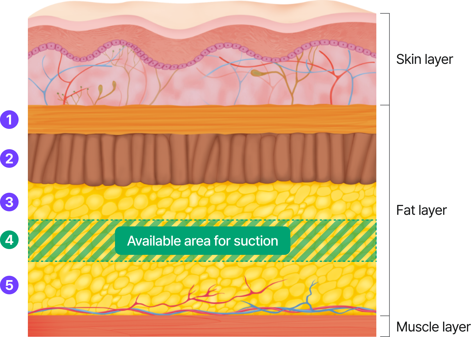 Skin layers, fat layers, muscle layers