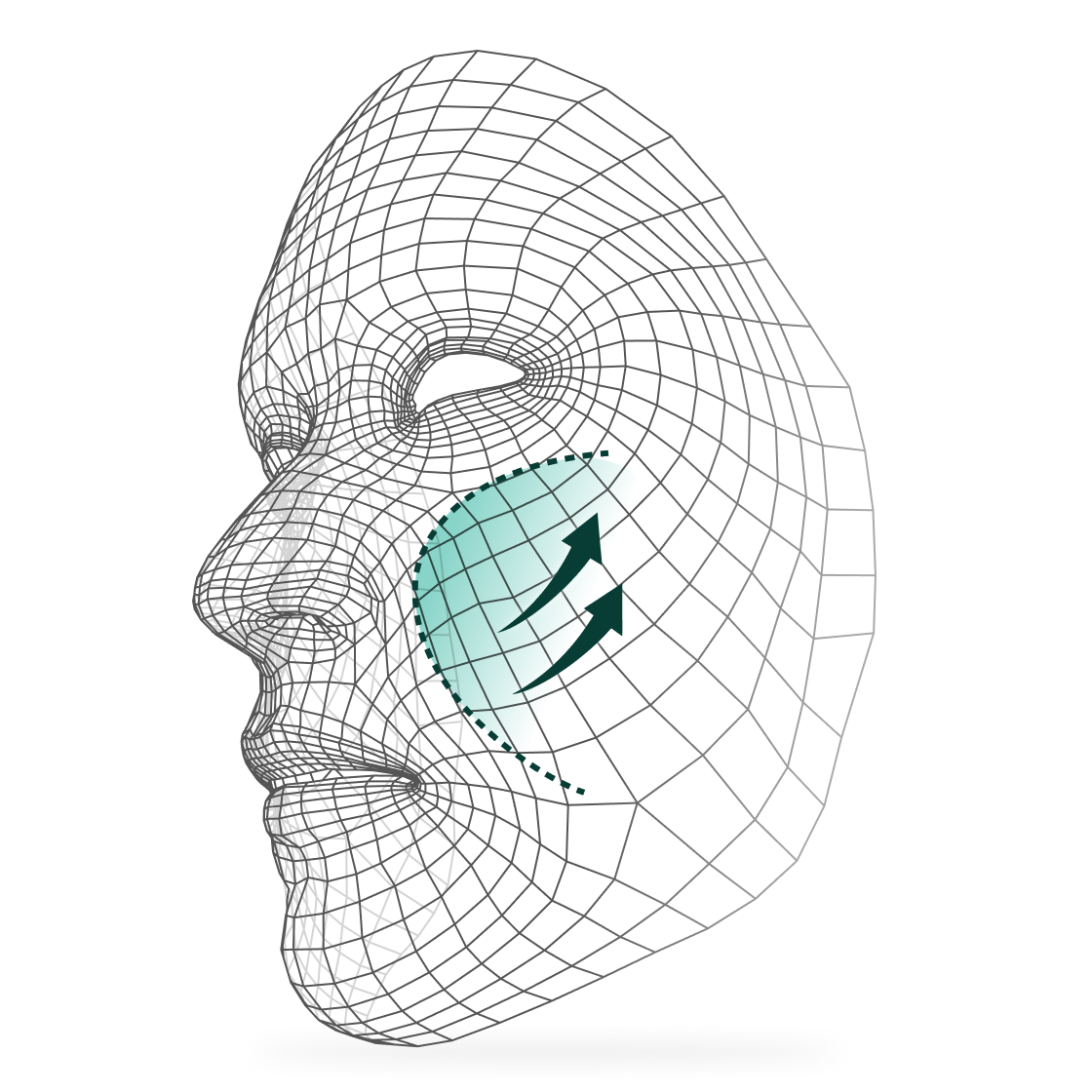 Facial Elevation