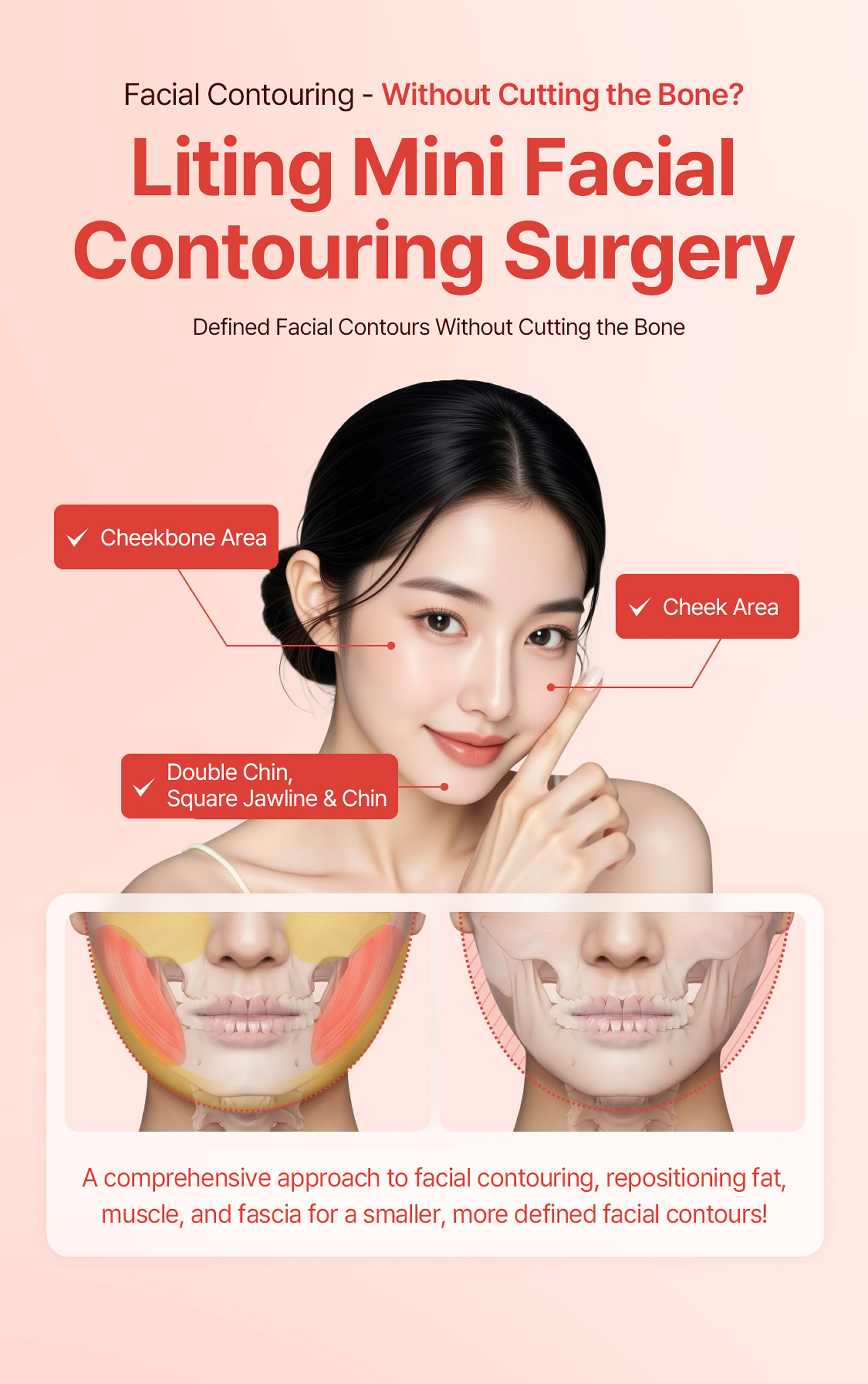 Lifting Mini Facial Contouring Surgery